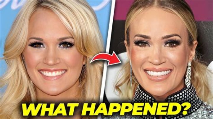 Carrie Underwood “Questioned Whether Her Career Was Over” After Face Injury