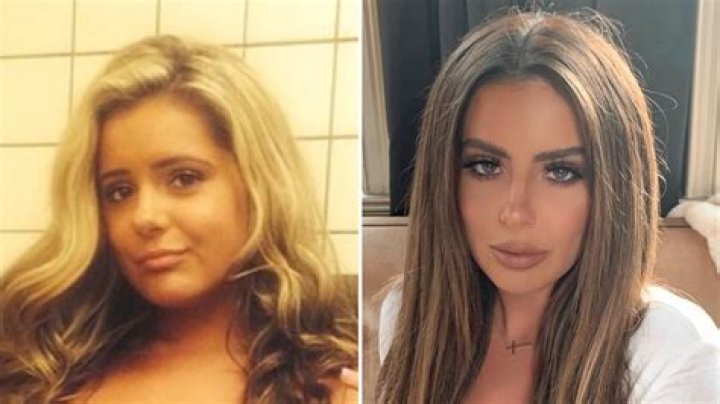 Don’t Be Tardy’s Kim Zolciak-Biermann’s Transformation Over the Years: Plastic Surgery Quotes, Photos
