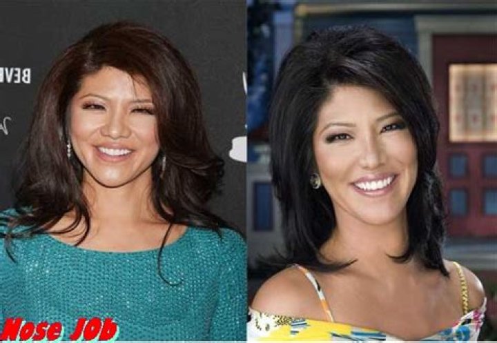 Julie Chen Plastic Surgery: Before and After, Nose Job, Eye Surgery