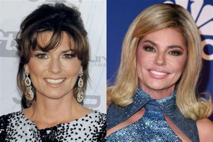 Knifestyles of the Rich & FamousExperts Weigh in On Shania Twain’s Youthful Face!