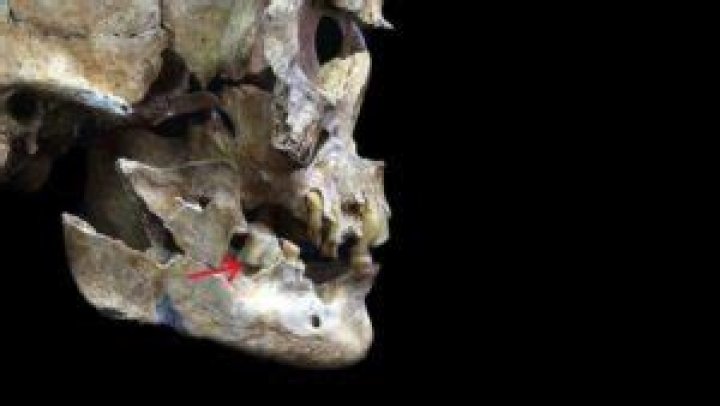 Scientists Reconstruct Ancient Japanese Woman Using Her Tooth