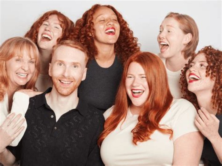 Why do redheads have yellow teeth? – Celebrity.fm – #1 Official Stars, Business & People Network, Wiki, Success story, Biography & Quotes
