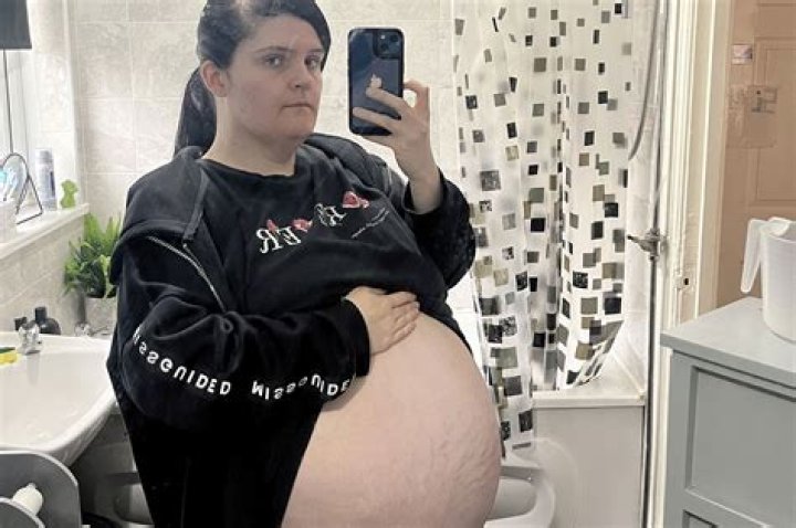 Woman's Three-Year 'Pregnancy' Was Actually 57-Pound Cyst